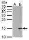 H2A Histone Family Member X antibody, GTX628996, GeneTex, Western Blot image 