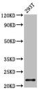 Charged Multivesicular Body Protein 1A antibody, CSB-PA881032LA01HU, Cusabio, Western Blot image 