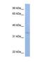 ST6 N-Acetylgalactosaminide Alpha-2,6-Sialyltransferase 3 antibody, NBP1-69326, Novus Biologicals, Western Blot image 