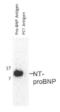 NT-proBNP antibody, 54-303, ProSci, Enzyme Linked Immunosorbent Assay image 