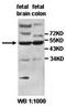 Interferon Induced Protein With Tetratricopeptide Repeats 5 antibody, orb77953, Biorbyt, Western Blot image 