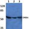 Putative EGF-like module-containing mucin-like hormone receptor-like 4 antibody, PA5-36374, Invitrogen Antibodies, Western Blot image 