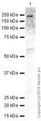 Transforming Growth Factor Beta Receptor 2 antibody, ab78419, Abcam, Western Blot image 