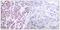 Nuclear Factor Kappa B Subunit 2 antibody, GTX50376, GeneTex, Immunohistochemistry paraffin image 