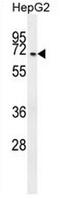 CFAP45 antibody, AP50773PU-N, Origene, Western Blot image 