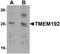 Transmembrane Protein 192 antibody, PA5-21118, Invitrogen Antibodies, Western Blot image 