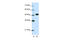 Eukaryotic Translation Initiation Factor 4A2 antibody, 29-278, ProSci, Western Blot image 