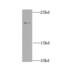 NADH:Ubiquinone Oxidoreductase Core Subunit S7 antibody, FNab05634, FineTest, Western Blot image 