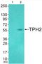 Tryptophan Hydroxylase 2 antibody, abx013001, Abbexa, Western Blot image 