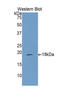 Arachidonate 15-Lipoxygenase antibody, LS-C300672, Lifespan Biosciences, Western Blot image 