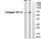 Collagen Type XIII Alpha 1 Chain antibody, PA5-38891, Invitrogen Antibodies, Western Blot image 