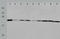 Peroxiredoxin 1 antibody, TA324140, Origene, Western Blot image 