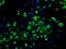 Hydroxysteroid 17-Beta Dehydrogenase 10 antibody, M03844-2, Boster Biological Technology, Immunofluorescence image 