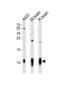 S100 Calcium Binding Protein B antibody, 61-780, ProSci, Western Blot image 