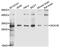 Sodium Voltage-Gated Channel Beta Subunit 1 antibody, A10071, ABclonal Technology, Western Blot image 