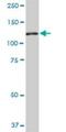 NIMA Related Kinase 9 antibody, H00091754-M01, Novus Biologicals, Western Blot image 