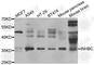 Inhibin Subunit Beta C antibody, A7559, ABclonal Technology, Western Blot image 