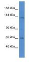 Integrin Subunit Alpha 7 antibody, NBP1-74207, Novus Biologicals, Western Blot image 