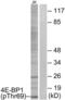 Eukaryotic Translation Initiation Factor 4E Binding Protein 1 antibody, LS-C291147, Lifespan Biosciences, Western Blot image 