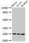 Vesicle Associated Membrane Protein 7 antibody, LS-C318981, Lifespan Biosciences, Western Blot image 