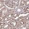 LAS1 Like, Ribosome Biogenesis Factor antibody, HPA061463, Atlas Antibodies, Immunohistochemistry frozen image 