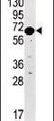 BR Serine/Threonine Kinase 2 antibody, PA5-14009, Invitrogen Antibodies, Western Blot image 