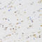 Cholinergic Receptor Muscarinic 5 antibody, STJ27320, St John