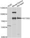 SET Domain Bifurcated Histone Lysine Methyltransferase 2 antibody, STJ29528, St John