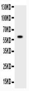 ADAM Metallopeptidase With Thrombospondin Type 1 Motif 4 antibody, LS-C662170, Lifespan Biosciences, Western Blot image 