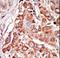 Eukaryotic Translation Initiation Factor 2 Alpha Kinase 2 antibody, LS-C101295, Lifespan Biosciences, Immunohistochemistry paraffin image 