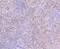 BAF Chromatin Remodeling Complex Subunit BCL11A antibody, A00741, Boster Biological Technology, Immunohistochemistry paraffin image 