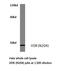 Vitamin D Receptor antibody, AP20319PU-N, Origene, Western Blot image 