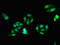Phenylalanyl-TRNA Synthetase Subunit Beta antibody, orb53875, Biorbyt, Immunocytochemistry image 