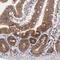 BAI1 Associated Protein 2 Like 2 antibody, NBP1-83596, Novus Biologicals, Immunohistochemistry paraffin image 