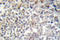 Fibronectin 1 antibody, LS-C176514, Lifespan Biosciences, Immunohistochemistry paraffin image 
