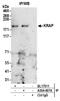 ITPR Interacting Domain Containing 2 antibody, A304-607A, Bethyl Labs, Immunoprecipitation image 