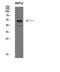 Immunoglobulin Heavy Constant Mu antibody, A07469, Boster Biological Technology, Western Blot image 