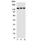 Toll Like Receptor 10 antibody, R31061, NSJ Bioreagents, Western Blot image 