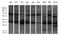 Proteasome Subunit Alpha 7 antibody, LS-C792446, Lifespan Biosciences, Western Blot image 