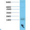 Transthyretin antibody, LS-C813248, Lifespan Biosciences, Western Blot image 