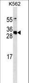 Serum amyloid P-component antibody, LS-C156398, Lifespan Biosciences, Western Blot image 