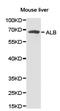 Albumin antibody, LS-C192691, Lifespan Biosciences, Western Blot image 