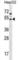 Arylacetamide Deacetylase Like 2 antibody, abx029488, Abbexa, Western Blot image 