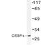 CCAAT Enhancer Binding Protein Delta antibody, LS-C176771, Lifespan Biosciences, Western Blot image 