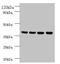 Family With Sequence Similarity 110 Member B antibody, orb238433, Biorbyt, Western Blot image 