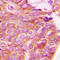 Ras Homolog Family Member A antibody, LS-C368499, Lifespan Biosciences, Immunohistochemistry paraffin image 