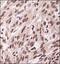 Insulin Like Growth Factor 1 Receptor antibody, NBP1-77679, Novus Biologicals, Immunohistochemistry paraffin image 