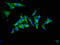 Tribbles Pseudokinase 2 antibody, LS-C670272, Lifespan Biosciences, Immunofluorescence image 