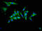 Tribbles homolog 2 antibody, LS-C670272, Lifespan Biosciences, Immunofluorescence image 