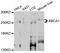 ATP Binding Cassette Subfamily A Member 1 antibody, abx005455, Abbexa, Western Blot image 
